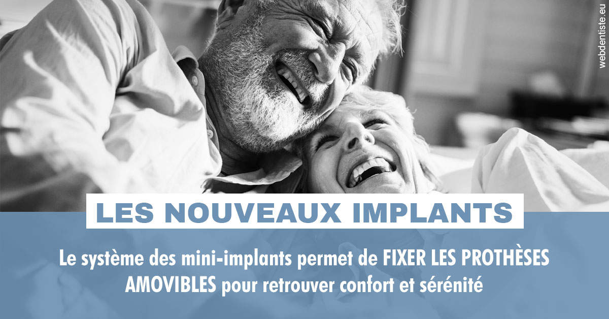 https://dr-ann-dorothee-mougin-claudon.chirurgiens-dentistes.fr/Les nouveaux implants 2