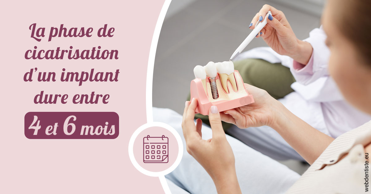 https://dr-ann-dorothee-mougin-claudon.chirurgiens-dentistes.fr/Cicatrisation implant 2
