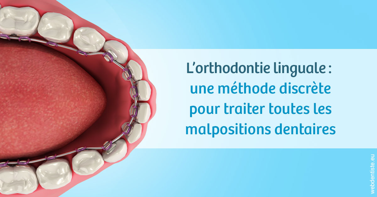 https://dr-ann-dorothee-mougin-claudon.chirurgiens-dentistes.fr/L'orthodontie linguale 1