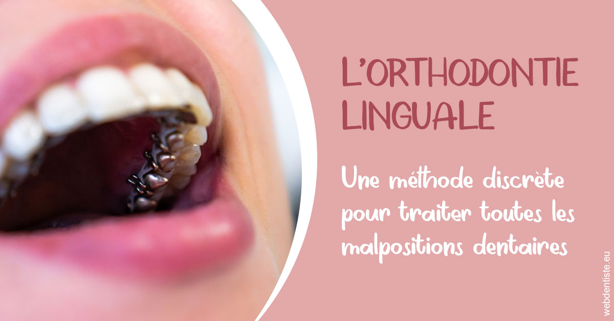 https://dr-ann-dorothee-mougin-claudon.chirurgiens-dentistes.fr/L'orthodontie linguale 2