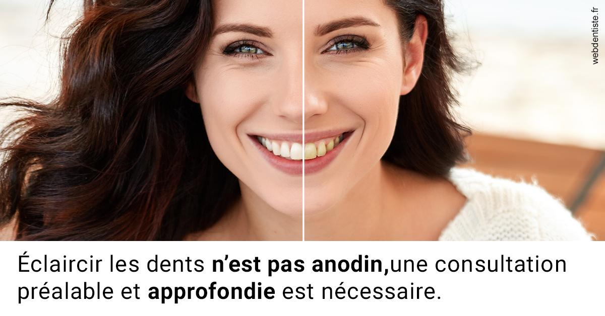 https://dr-ann-dorothee-mougin-claudon.chirurgiens-dentistes.fr/Le blanchiment 2