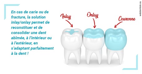 https://dr-ann-dorothee-mougin-claudon.chirurgiens-dentistes.fr/L'INLAY ou l'ONLAY