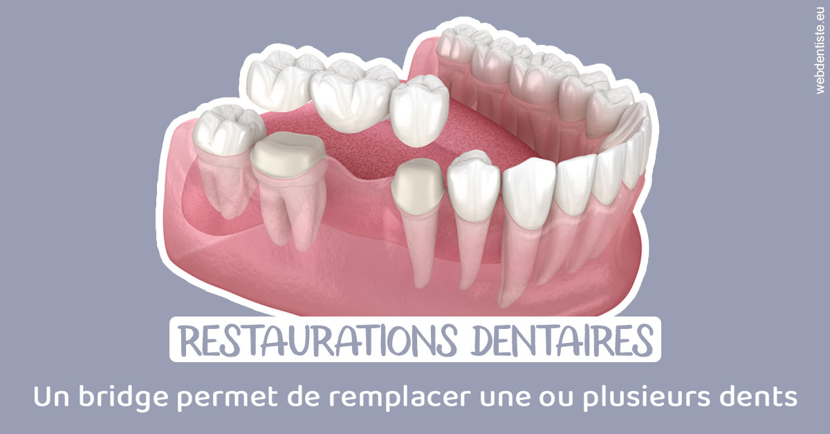 https://dr-ann-dorothee-mougin-claudon.chirurgiens-dentistes.fr/Bridge remplacer dents 1