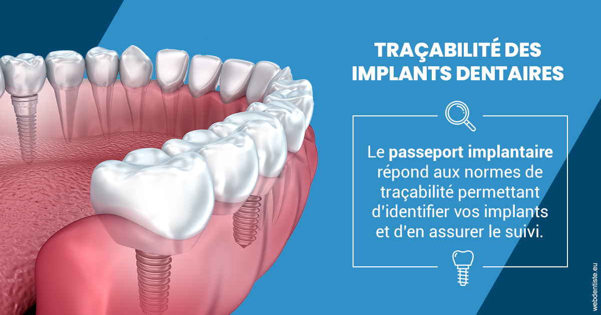 https://dr-ann-dorothee-mougin-claudon.chirurgiens-dentistes.fr/T2 2023 - Traçabilité des implants 1