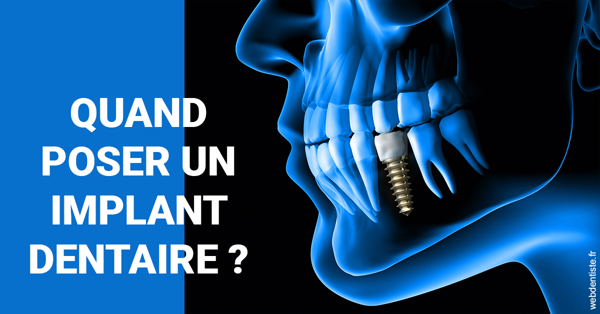 https://dr-ann-dorothee-mougin-claudon.chirurgiens-dentistes.fr/Les implants 1