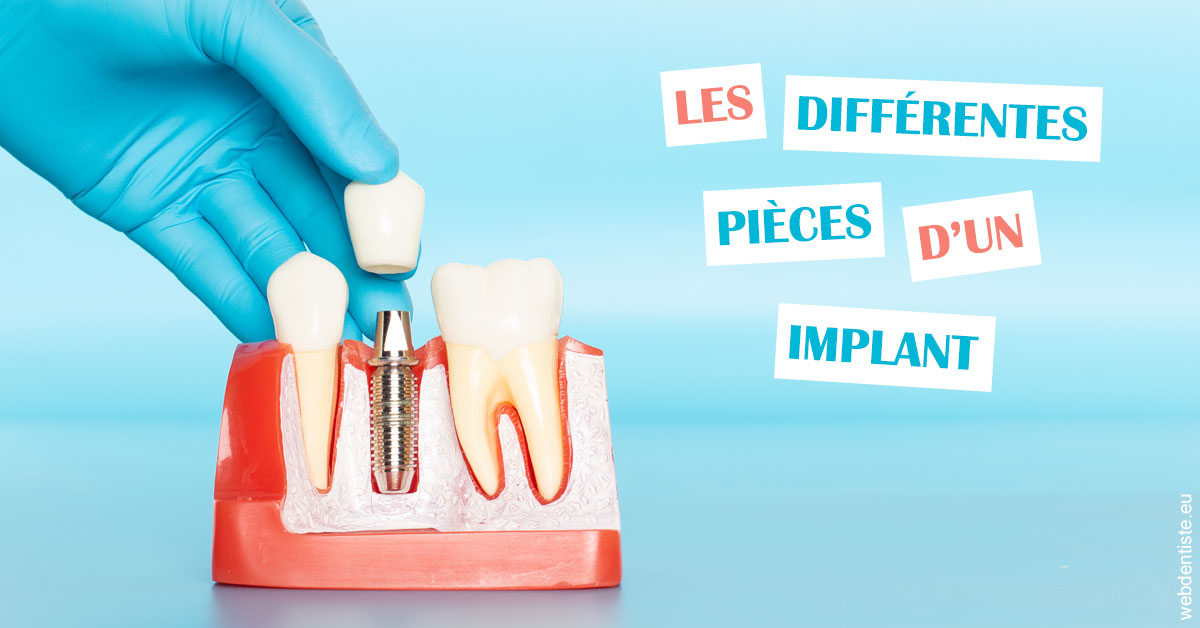https://dr-ann-dorothee-mougin-claudon.chirurgiens-dentistes.fr/Les différentes pièces d’un implant 2