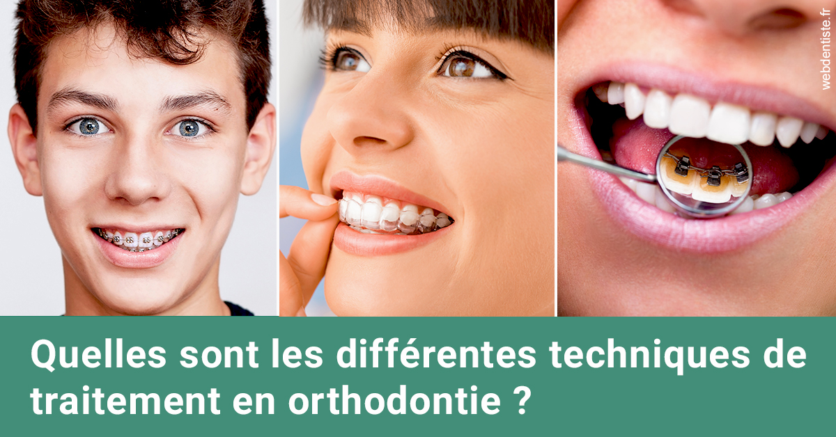 https://dr-ann-dorothee-mougin-claudon.chirurgiens-dentistes.fr/Les différentes techniques de traitement 2