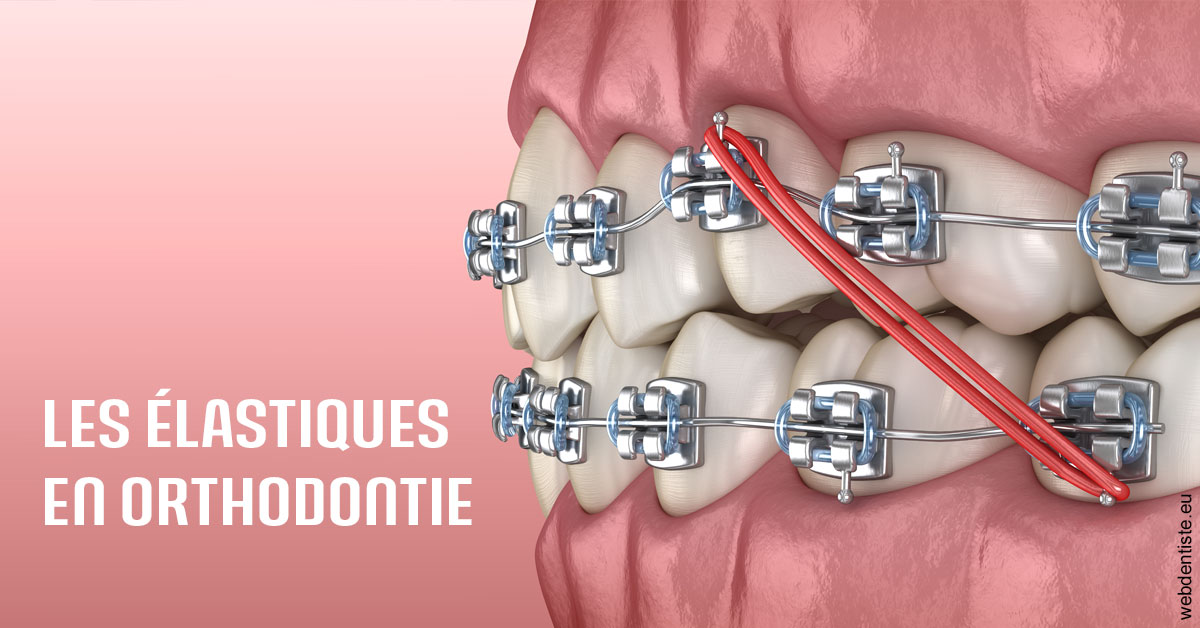 https://dr-ann-dorothee-mougin-claudon.chirurgiens-dentistes.fr/Elastiques orthodontie 2